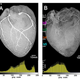 Illustration for article titled This Is What a Heart Injected With Liquid Metal Looks Like